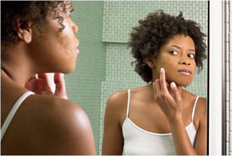 skin_problems_among_black_women