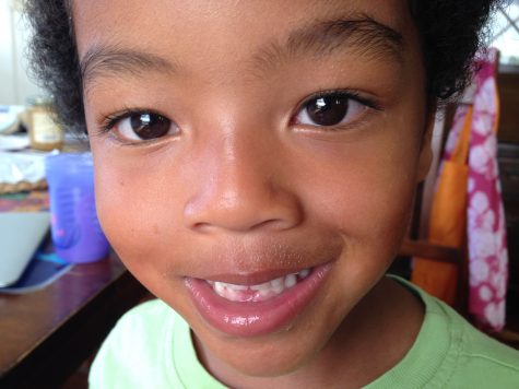 KidMissingTooth